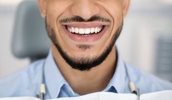 Dental Treatment Result. Closeup Shot Of Happy Young Arab Man Widely Smiling With His Perfect White Teeth While Sitting At Dentist Chair After Check Up In Modern Stomatological Clinic, Cropped Image